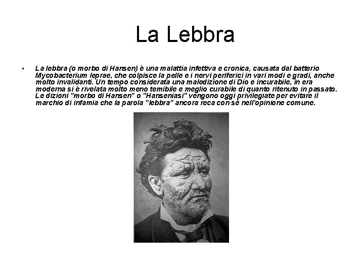 La Lebbra • La lebbra (o morbo di Hansen) è una malattia infettiva e