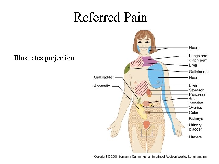 Referred Pain Illustrates projection. 