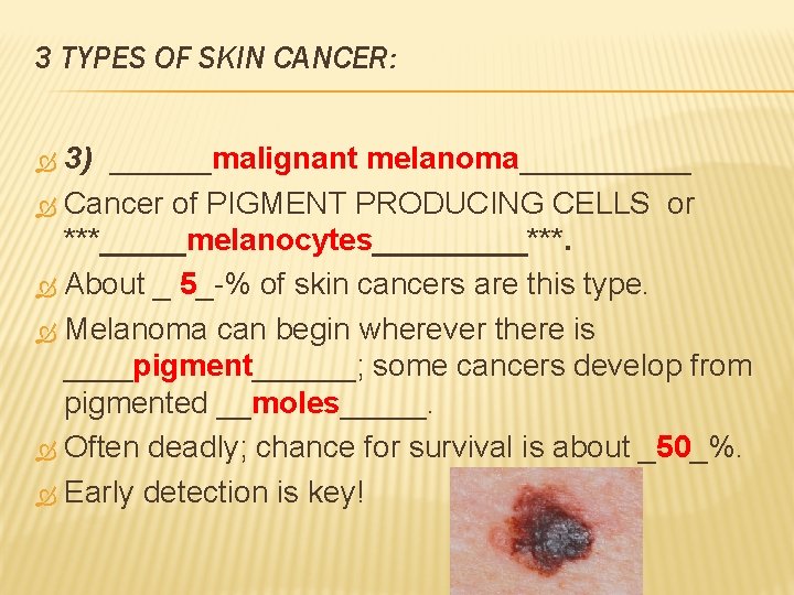 3 TYPES OF SKIN CANCER: 3) ______malignant melanoma_____ Cancer of PIGMENT PRODUCING CELLS or