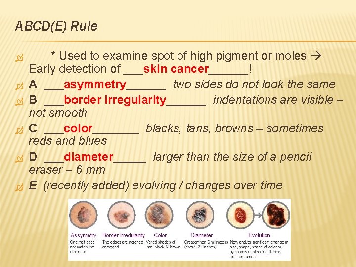 ABCD(E) Rule * Used to examine spot of high pigment or moles Early detection