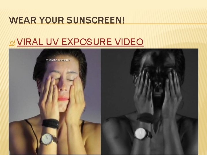 WEAR YOUR SUNSCREEN! VIRAL UV EXPOSURE VIDEO 