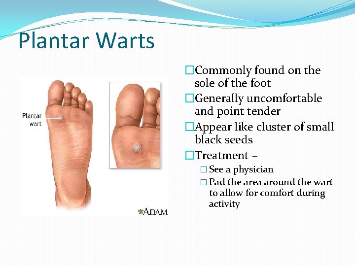 Plantar Warts �Commonly found on the sole of the foot �Generally uncomfortable and point
