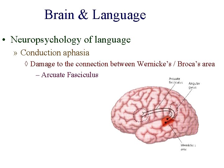 Brain & Language • Neuropsychology of language » Conduction aphasia ◊ Damage to the