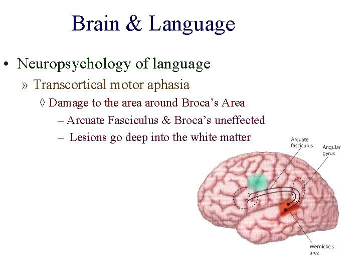 Brain & Language • Neuropsychology of language » Transcortical motor aphasia ◊ Damage to