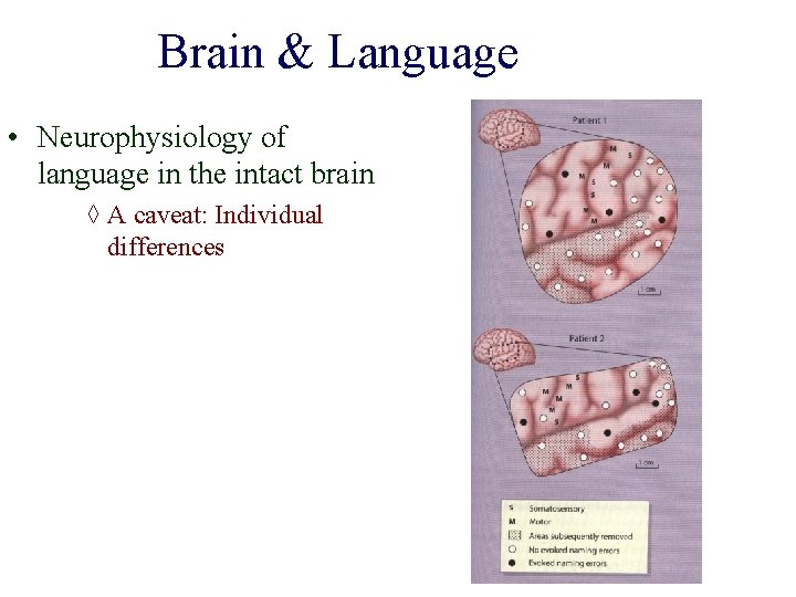 Brain & Language • Neurophysiology of language in the intact brain ◊ A caveat: