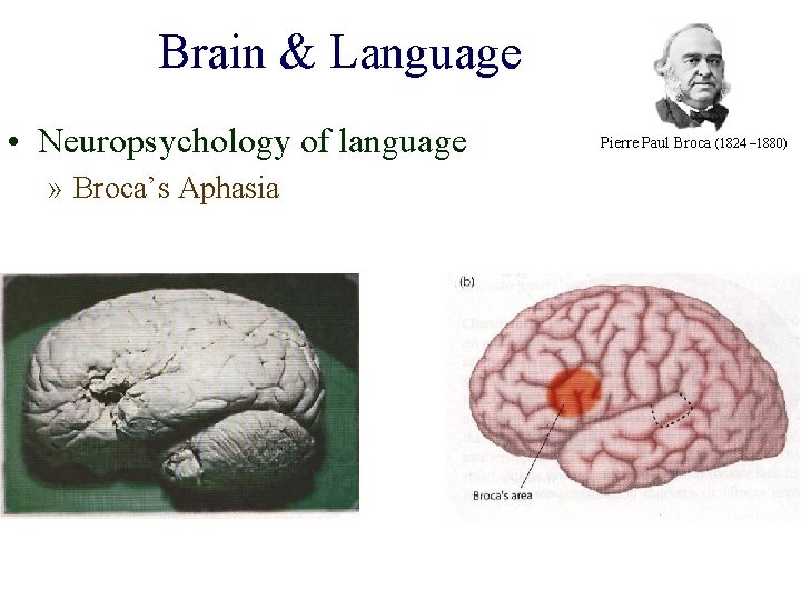 Brain & Language • Neuropsychology of language » Broca’s Aphasia Pierre Paul Broca (1824