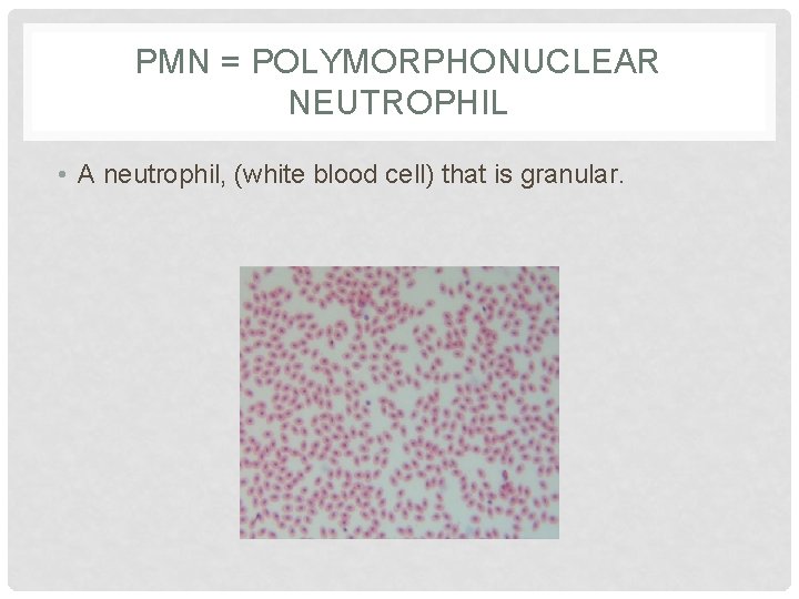 PMN = POLYMORPHONUCLEAR NEUTROPHIL • A neutrophil, (white blood cell) that is granular. 