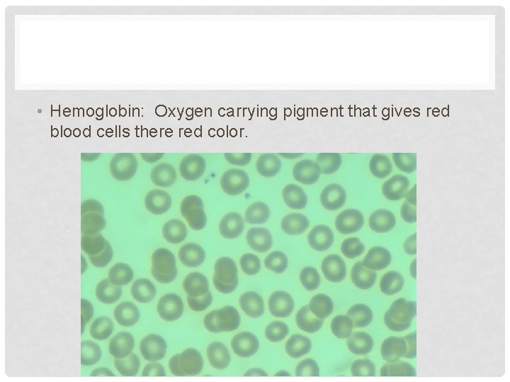  • Hemoglobin: Oxygen carrying pigment that gives red blood cells there red color.