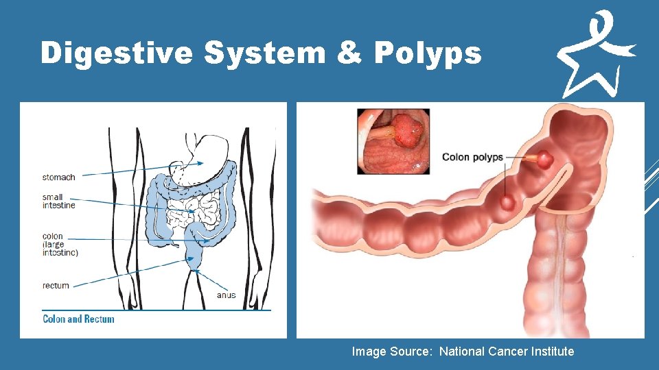 Digestive System & Polyps Image Source: National Cancer Institute 