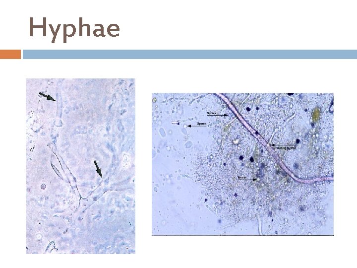 Hyphae 