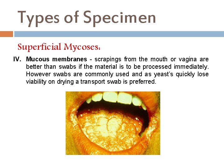Types of Specimen Superficial Mycoses: IV. Mucous membranes - scrapings from the mouth or