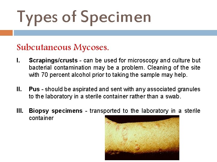 Types of Specimen Subcutaneous Mycoses. I. Scrapings/crusts - can be used for microscopy and