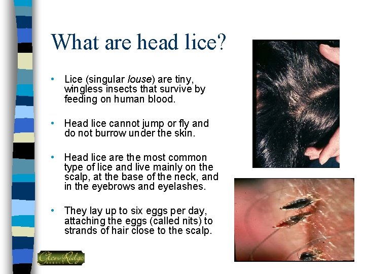 What are head lice? • Lice (singular louse) are tiny, wingless insects that survive