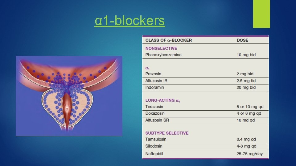 α 1 -blockers 
