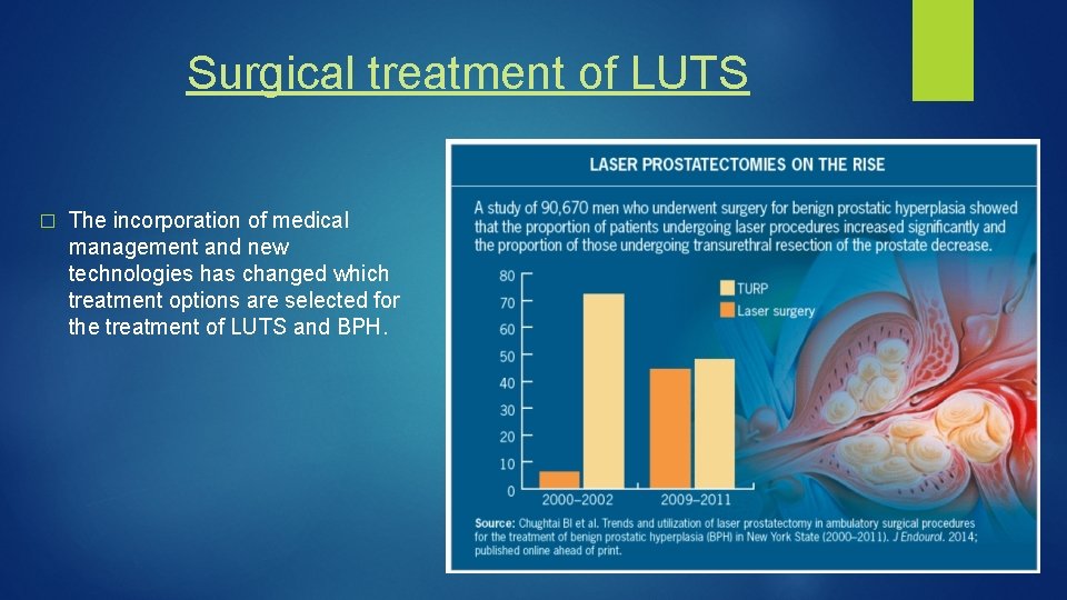 Surgical treatment of LUTS � The incorporation of medical management and new technologies has