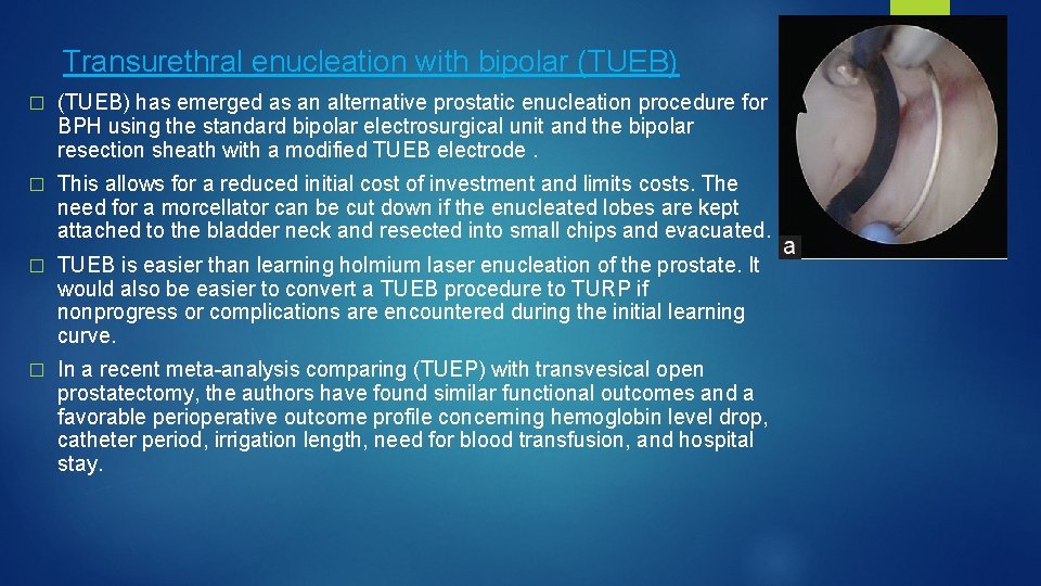 Transurethral enucleation with bipolar (TUEB) � (TUEB) has emerged as an alternative prostatic enucleation