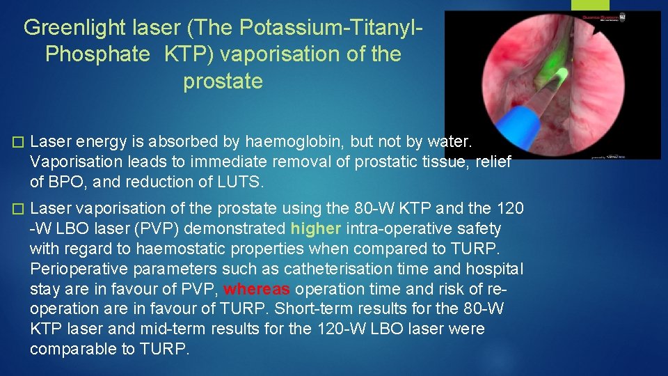 Greenlight laser (The Potassium-Titanyl. Phosphate KTP) vaporisation of the prostate � Laser energy is