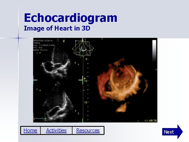 Echocardiogram Image of Heart in 3 D Home Activities Resources Next 