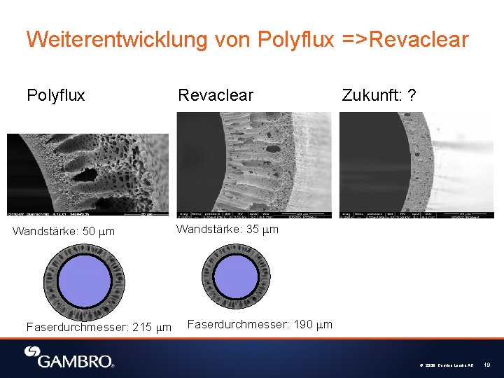 Weiterentwicklung von Polyflux =>Revaclear Polyflux Wandstärke: 50 mm Faserdurchmesser: 215 mm Revaclear Zukunft: ?