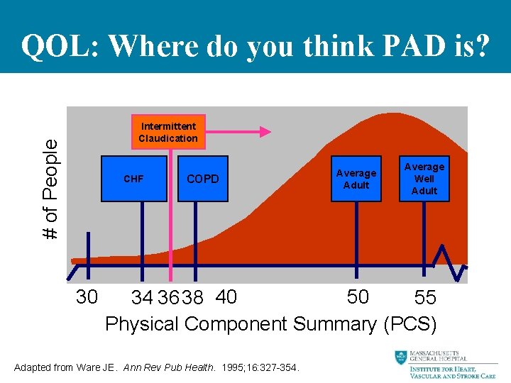 QOL: Where do you think PAD is? # of People Intermittent Claudication CHF 30