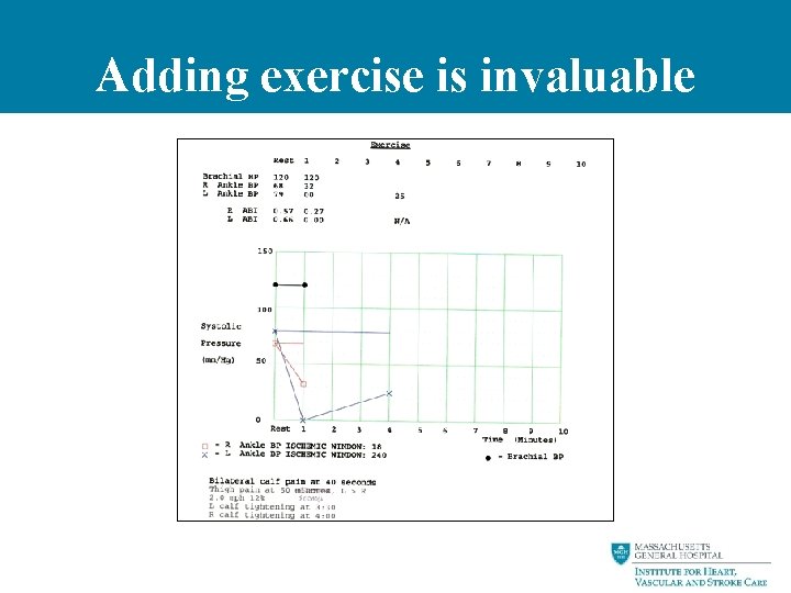 Adding exercise is invaluable 