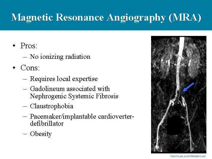 Magnetic Resonance Angiography (MRA) • Pros: – No ionizing radiation • Cons: – Requires