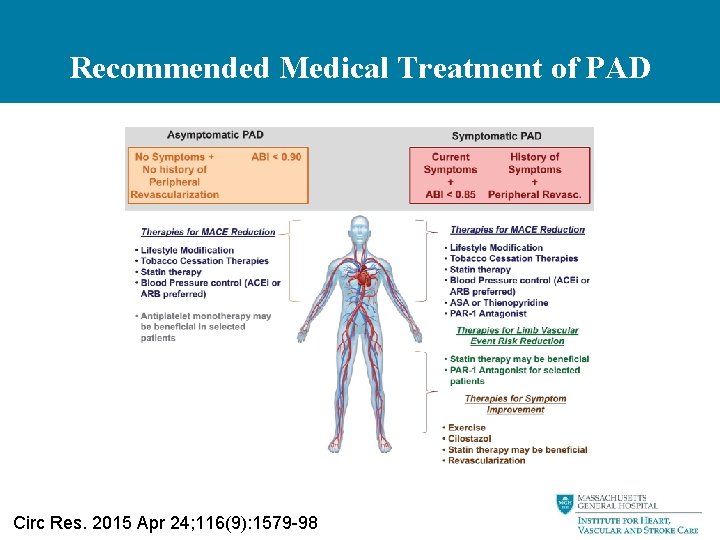 Recommended Medical Treatment of PAD Circ Res. 2015 Apr 24; 116(9): 1579 -98 