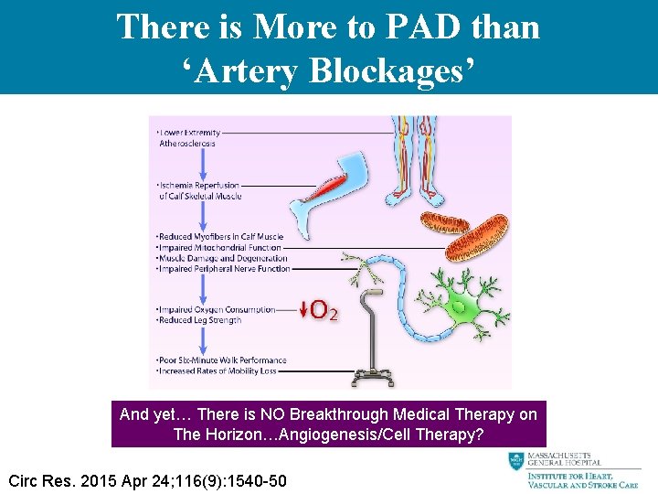 There is More to PAD than ‘Artery Blockages’ And yet… There is NO Breakthrough