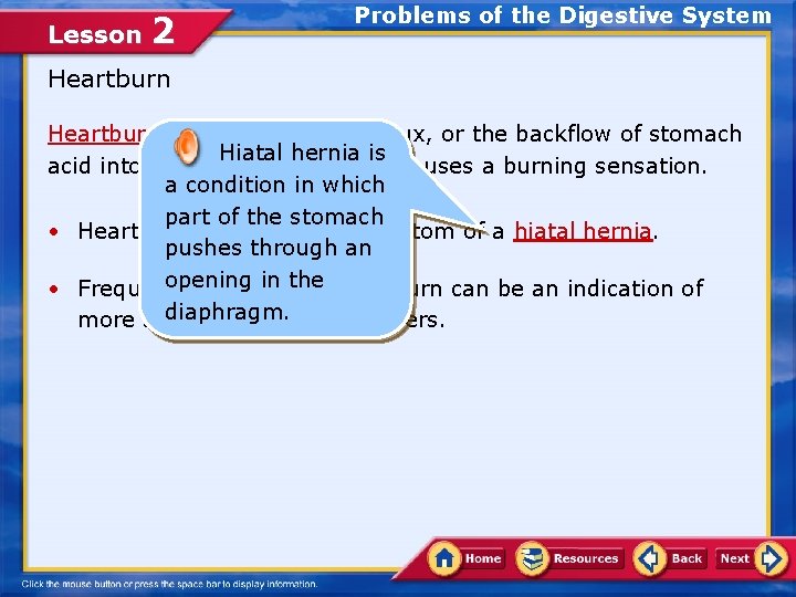 Lesson 2 Problems of the Digestive System Heartburn results from acid reflux, or the
