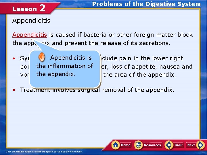 Lesson 2 Problems of the Digestive System Appendicitis is caused if bacteria or other