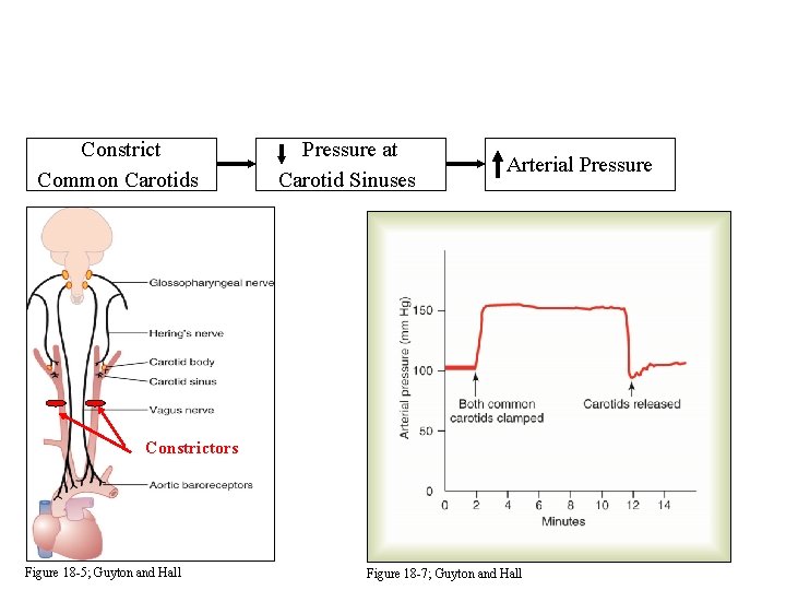 Constrict Common Carotids Pressure at Carotid Sinuses Arterial Pressure Constrictors Figure 18 -5; Guyton