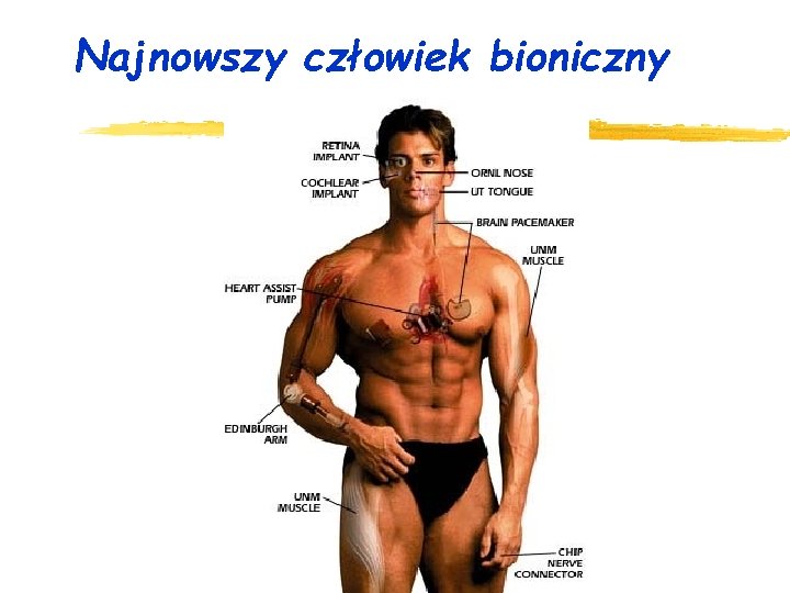 Najnowszy człowiek bioniczny 