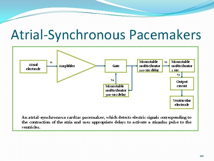 Atrial-Synchronous Pacemakers Atrial electrode v 1 Amplififer Gate Monostable multivibrator 120 -ms delay v