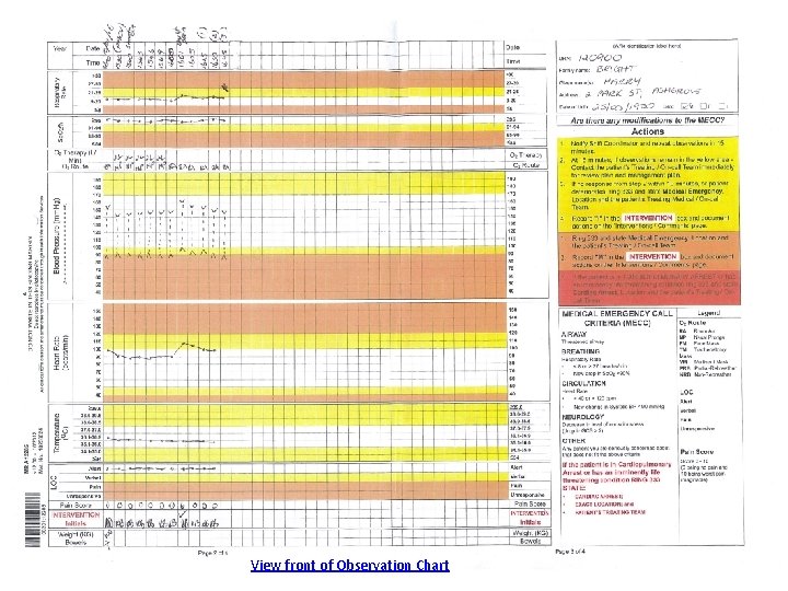 View front of Observation Chart 