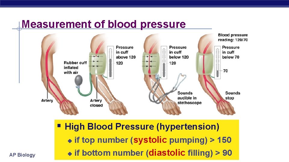 Measurement of blood pressure § High Blood Pressure (hypertension) AP Biology u if top