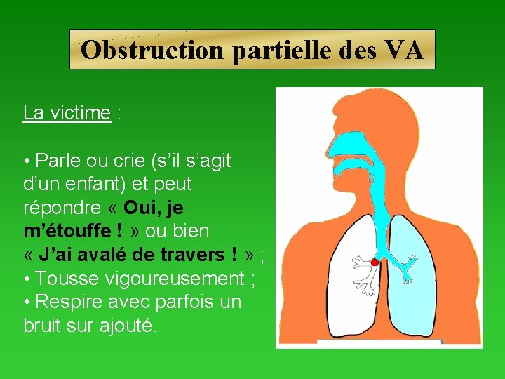 Obstruction partielle des VA La victime : • Parle ou crie (s’il s’agit d’un