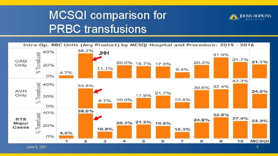 MCSQI comparison for PRBC transfusions JHH June 9, 2021 5 