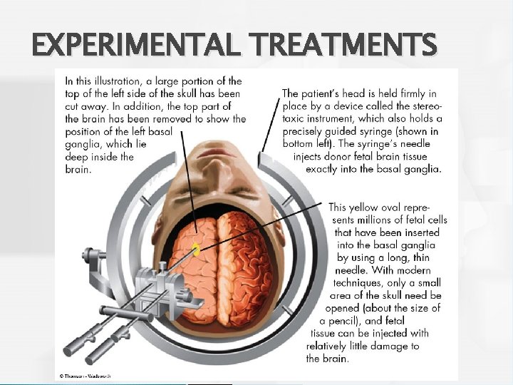 EXPERIMENTAL TREATMENTS 