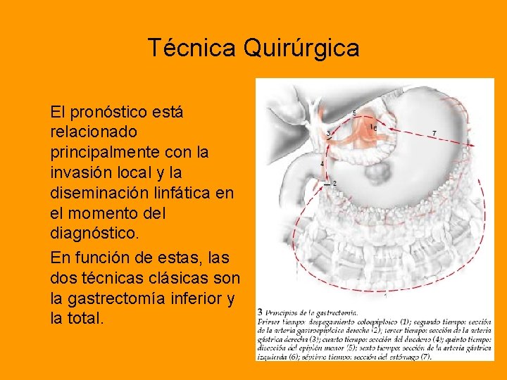 Técnica Quirúrgica El pronóstico está relacionado principalmente con la invasión local y la diseminación
