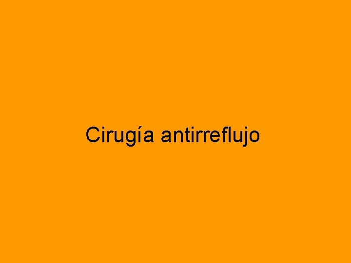Cirugía antirreflujo 