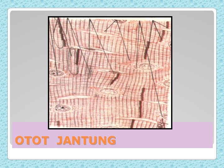 OTOT JANTUNG 