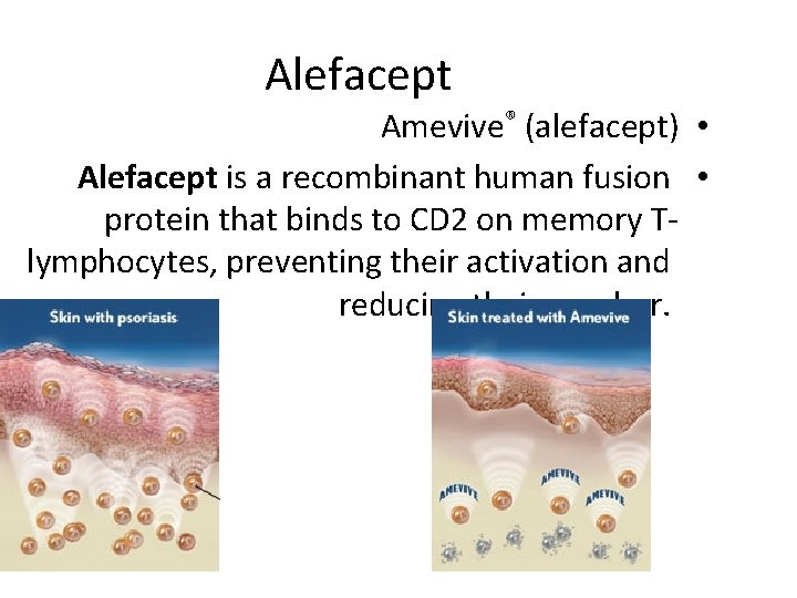 Alefacept Amevive® (alefacept) • Alefacept is a recombinant human fusion • protein that binds