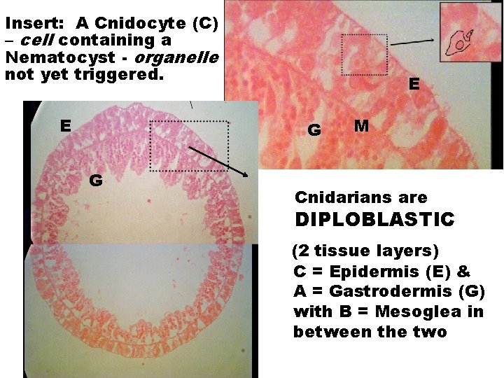 Insert: A Cnidocyte (C) – cell containing a Nematocyst - organelle not yet triggered.