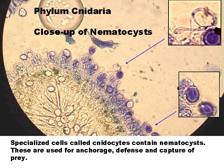 Phylum Cnidaria Close-up of Nematocysts Specialized cells called cnidocytes contain nematocysts. These are used