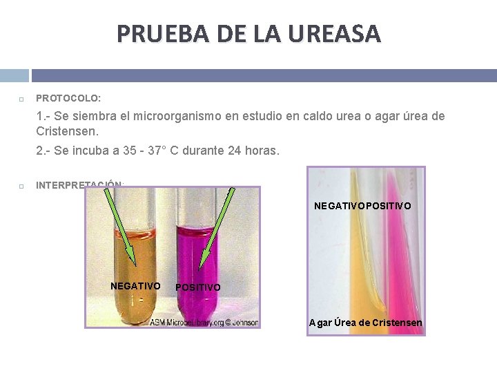 PRUEBA DE LA UREASA PROTOCOLO: 1. - Se siembra el microorganismo en estudio en