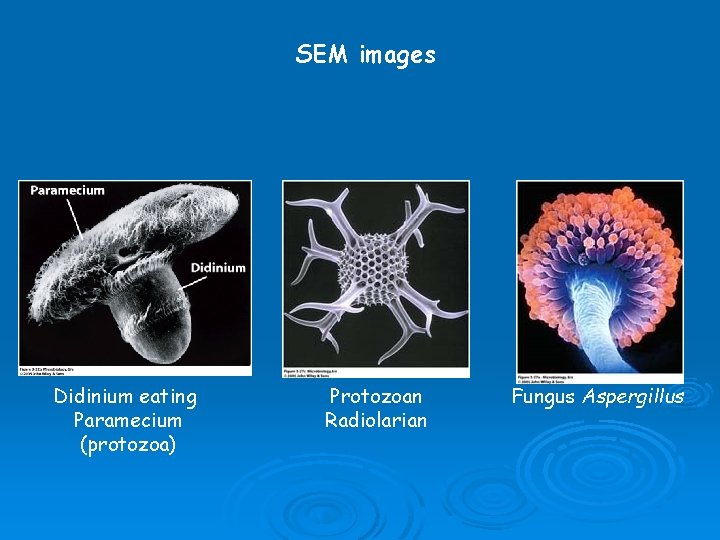 SEM images Didinium eating Paramecium (protozoa) Protozoan Radiolarian Fungus Aspergillus 