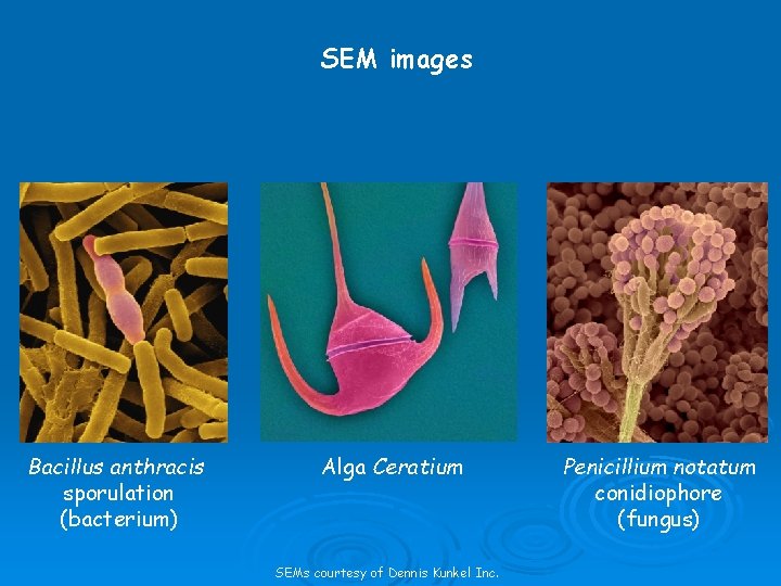 SEM images Bacillus anthracis sporulation (bacterium) Alga Ceratium SEMs courtesy of Dennis Kunkel Inc.