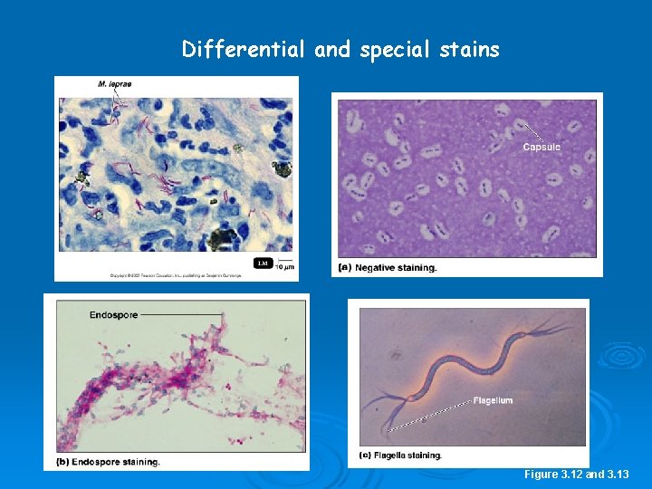 Differential and special stains Figure 3. 12 and 3. 13 