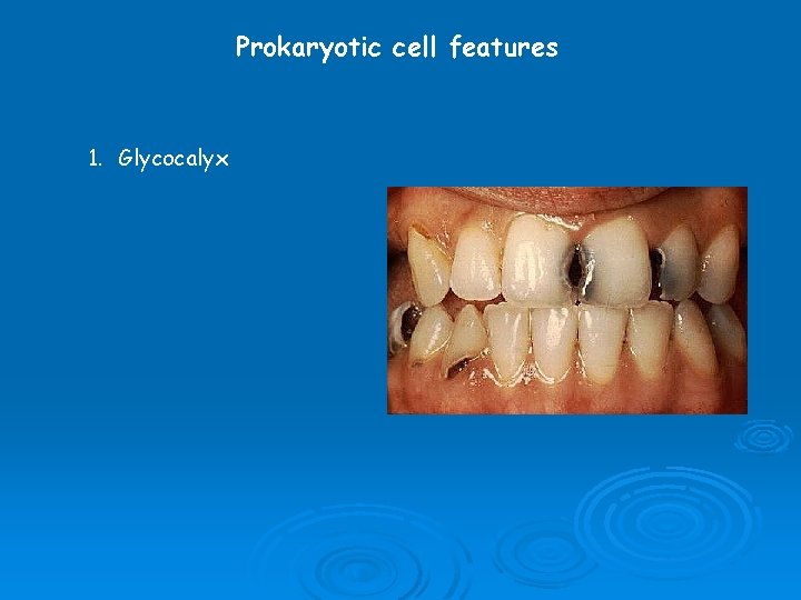 Prokaryotic cell features 1. Glycocalyx 