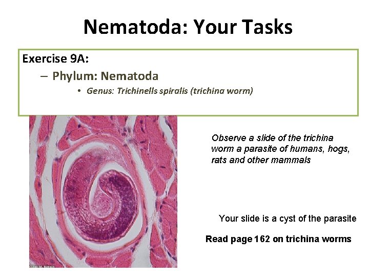 Nematoda: Your Tasks Exercise 9 A: – Phylum: Nematoda • Genus: Trichinells spiralis (trichina
